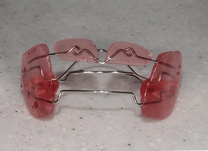 프랑켈 어린이 교정 장치, 구강 내 장착으로 턱 성장과 골격 발달을 조절